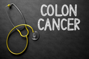 Facts To Know About Colon Cancer